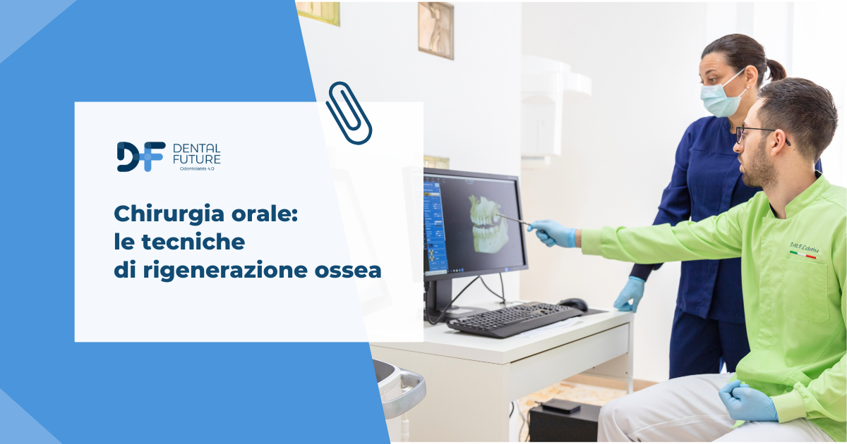 Chirurgia orale: le tecniche di rigenerazione ossea 