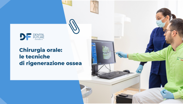 Chirurgia orale: le tecniche di rigenerazione ossea 